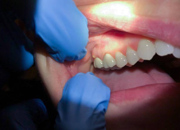 Best Urgent Dental Care for Toothaches in Calhoun City, MS