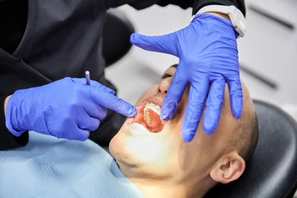 Best Emergency Care for Gum Disease in Calhoun City, MS